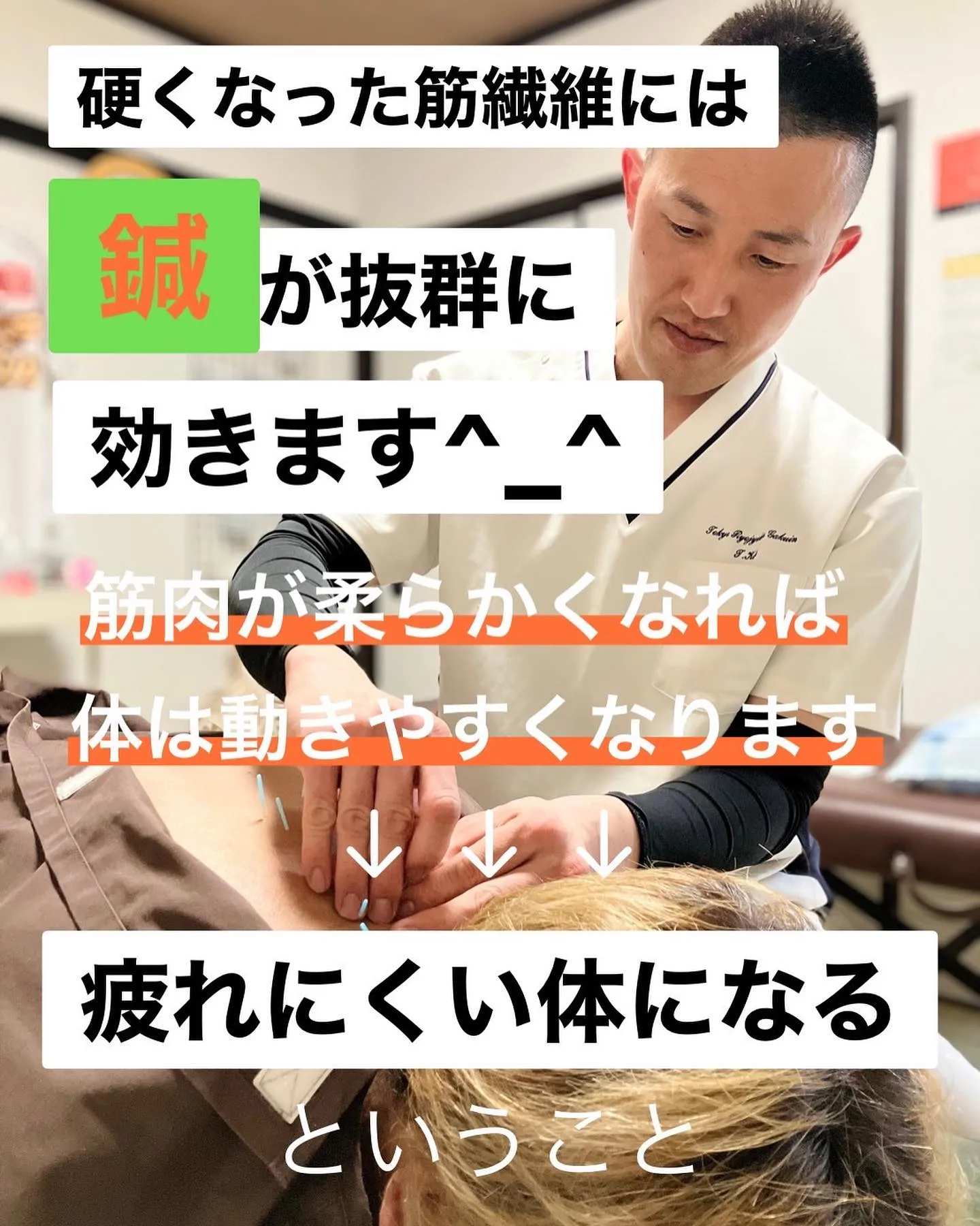 コリ固まった筋肉とは？鍼治療のすすめ