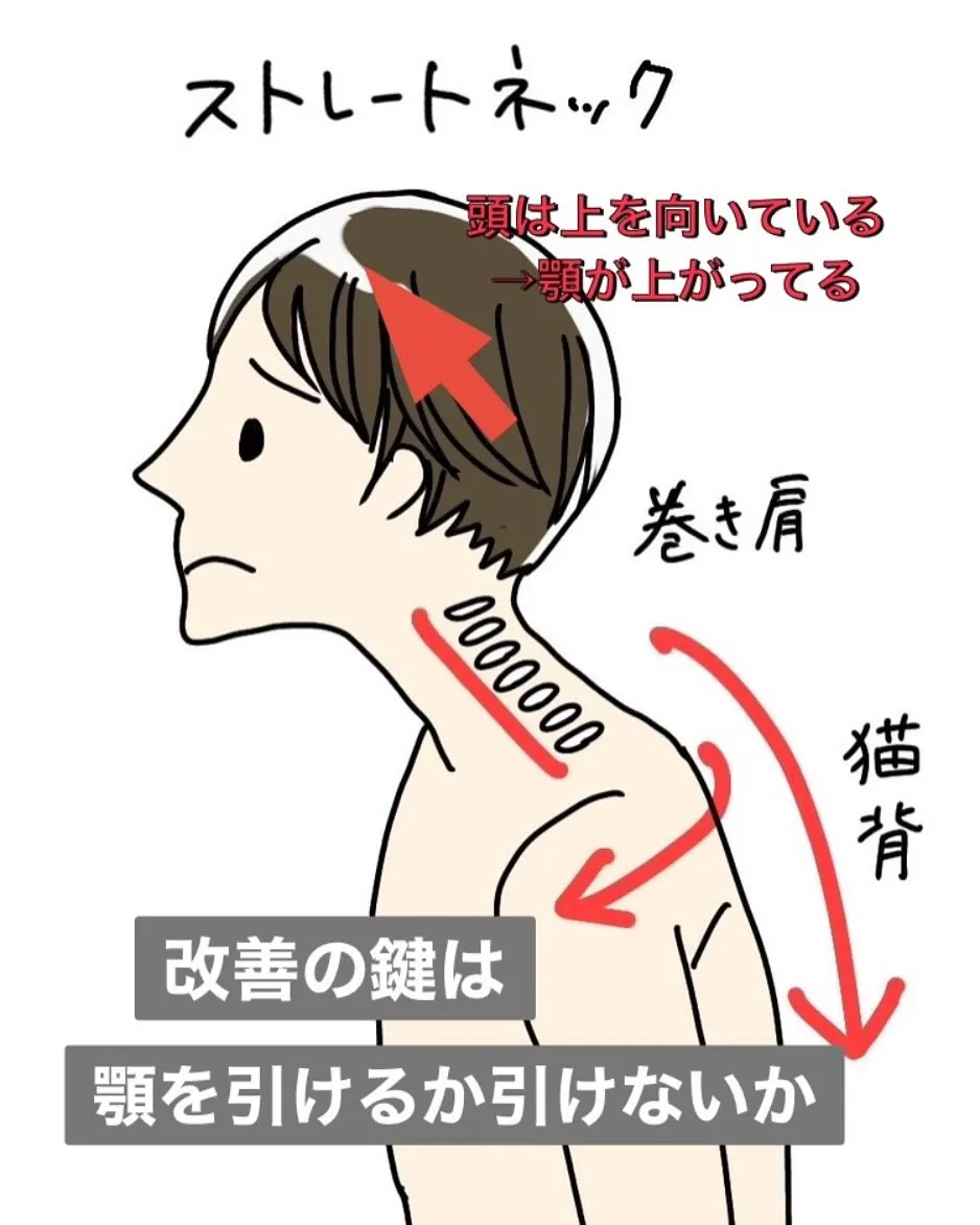 ストレートネック改善の鍵はアゴを引けるか、引けないか